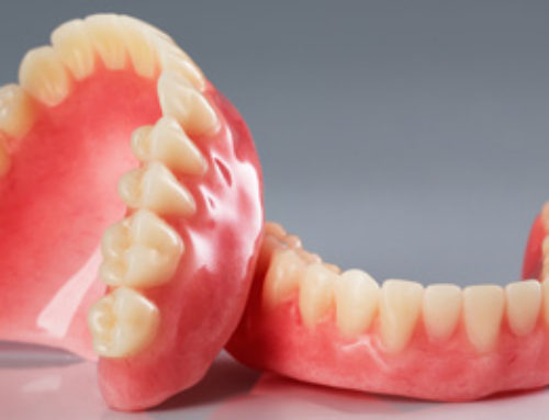 Full Dentures Top & Bottom